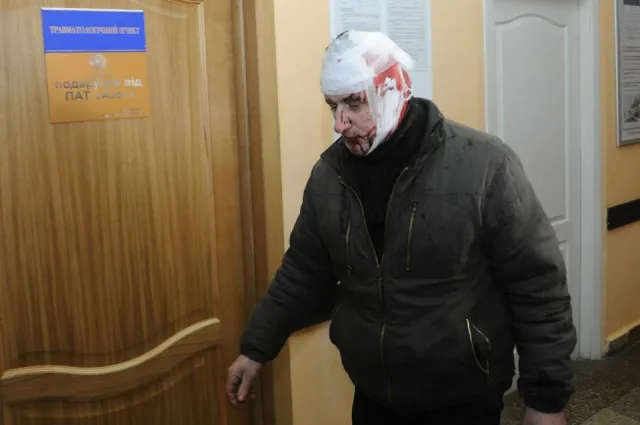 Побитий журналіст польського телеканалу про події у Черкасах: «Це – хардкор» — фото 4